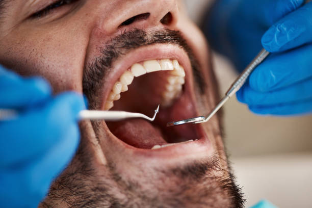 Best Cosmetic Emergency Dentistry in Huntertown, IN